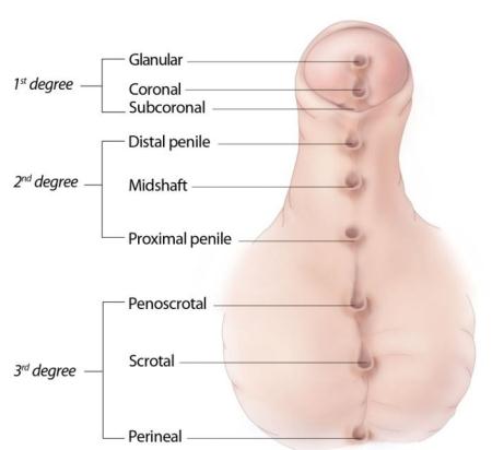 4. Ứng dụng từ 