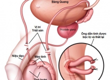 ĐIỀU ĐÁNG NGẠC NHIÊN SAU TRIỆT SẢN NAM tdty