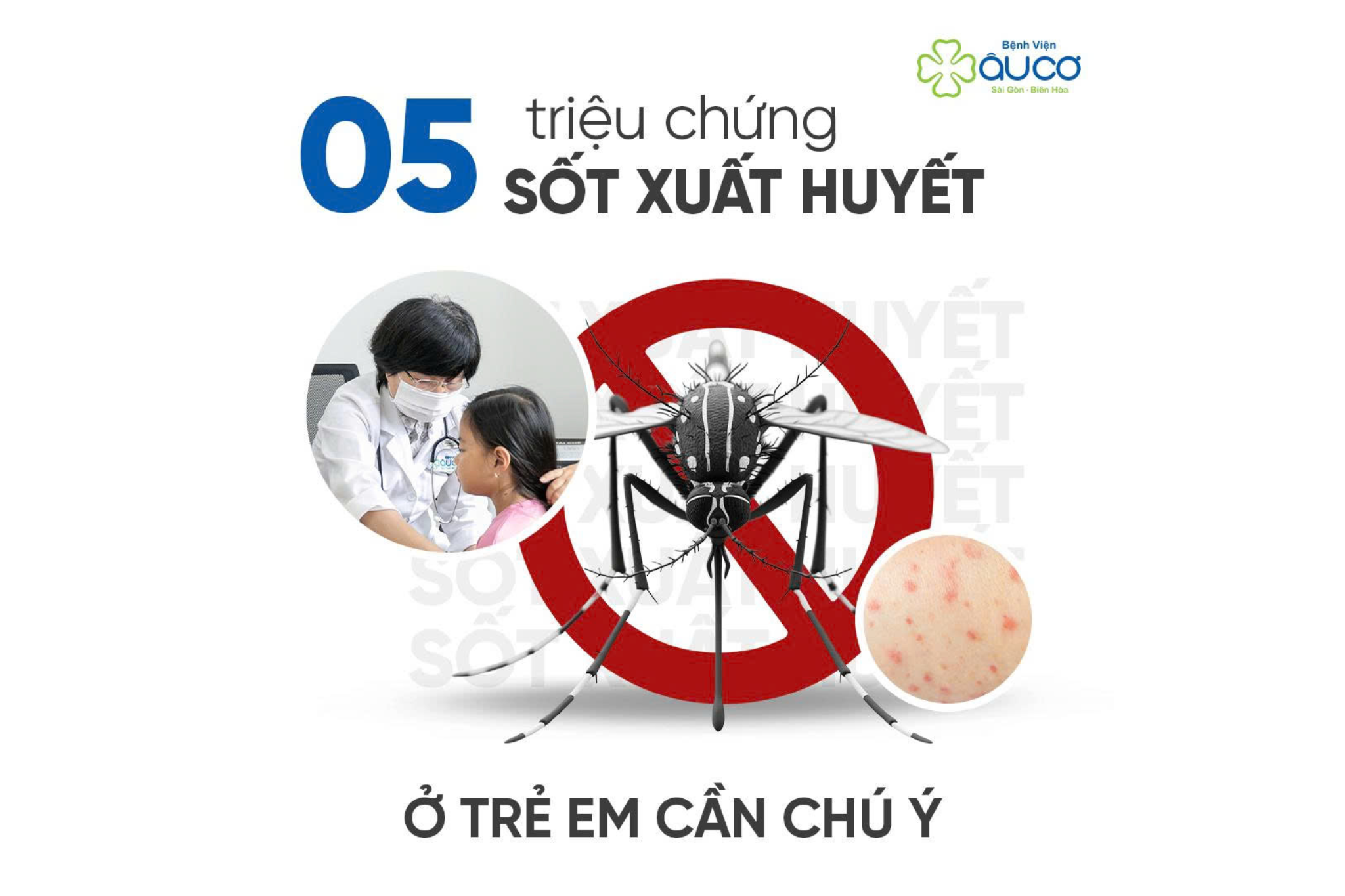 sot xuat huy