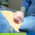 ivf a.jpg 1