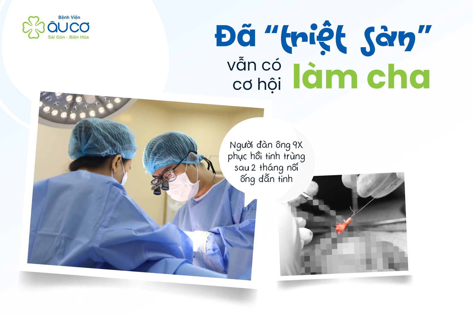 Nối ống dẫn tinh sau triệt sản