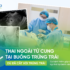 Thai ngoài tử cung tại buồng trứng