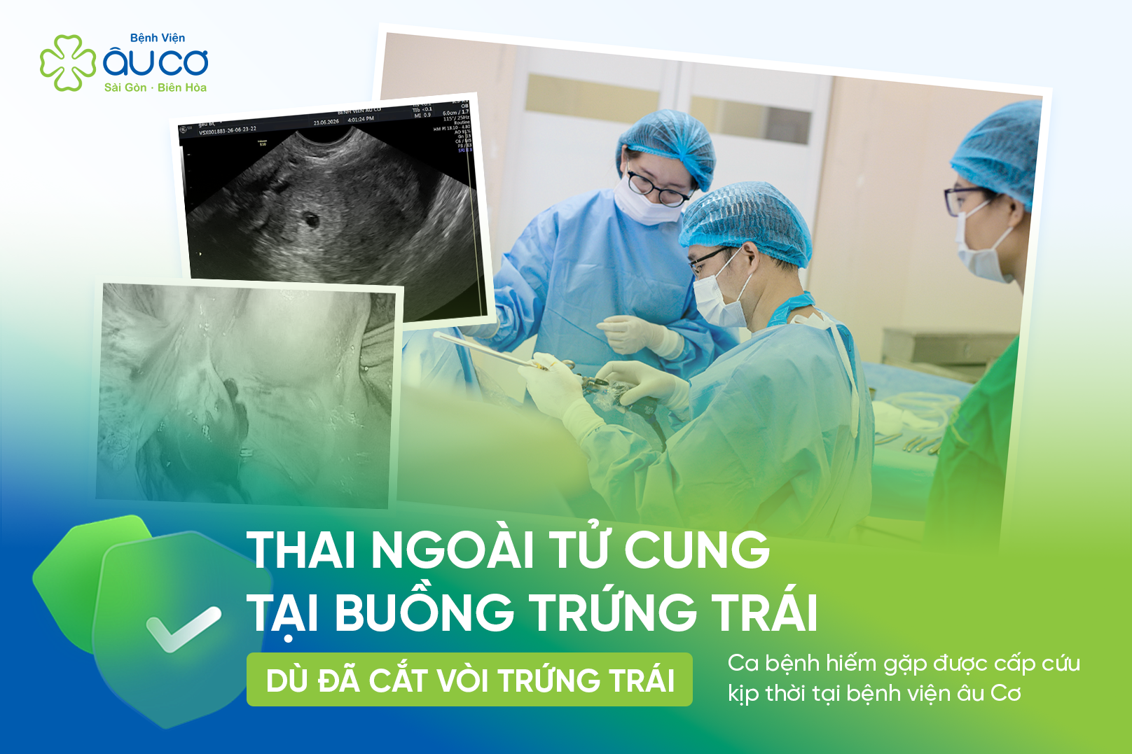 Thai ngoài tử cung tại buồng trứng